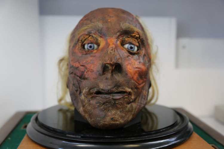 The preserved head of Jeremy Bentham, his head damaged in the preservation process which was understandably rather untested. Obviously his eyes aren't real and his wonderful brain was removed prior to the preservation.
